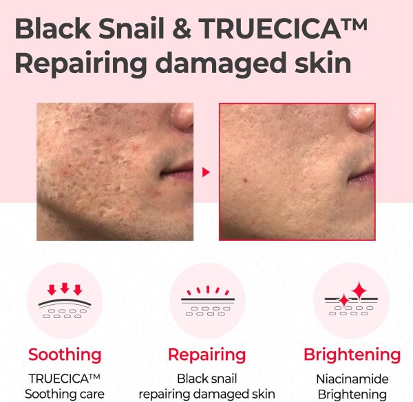 ⁦Some By Mi Snail Truecica Miracle Repair Toner 150ml⁩ - الصورة ⁦3⁩