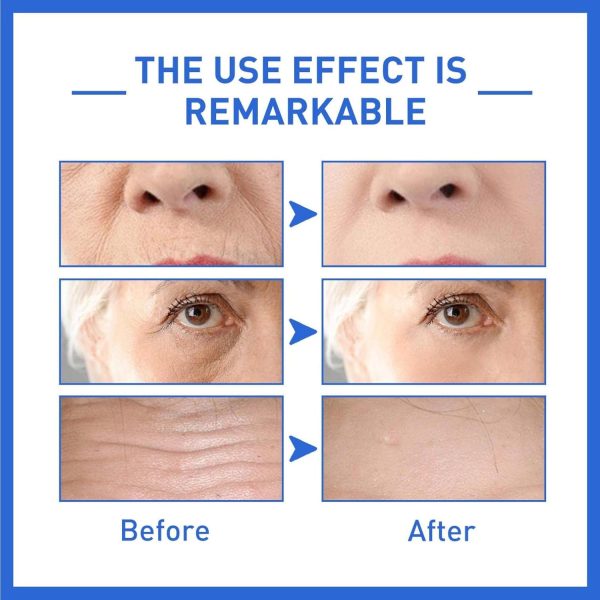 ⁦YoungAgain Botox Anti-Aging Serum, Hyaluronic Acid Serum, Youthfully Botox Face Serum, Collagen Boost Anti-Wrinkle Serum, Firming Lifting Skin Collagen Boost Anti-Aging Serum (2PC)⁩ - الصورة ⁦5⁩