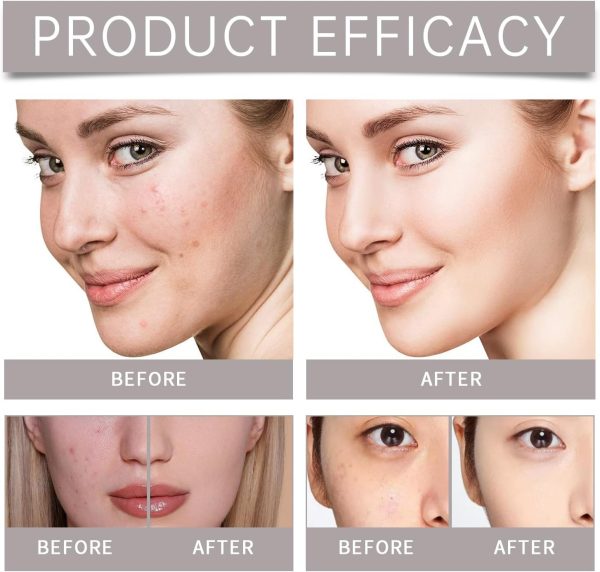 ⁦Salasabil Acne Care set/Brightening skin/gently moisturizing/repairing skin/moisturizing facial set⁩ - الصورة ⁦4⁩