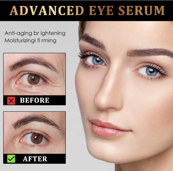 ⁦2Pcs Roller Ball Castor Oil, Castor Oil Frankincense Rollerball, for Eyes, Bags Under Eyes⁩ - الصورة ⁦3⁩