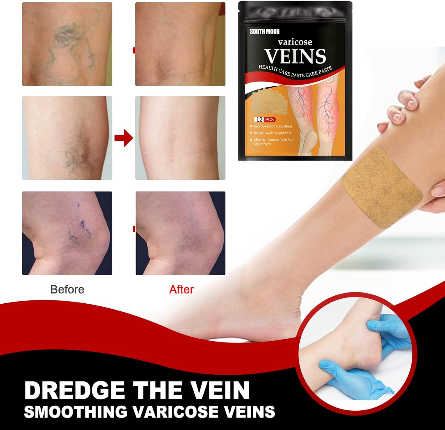 Varicose Vein Patch Treatment for Legs veinhealth varicose veins treatment patch vein healing varicose veins treatment Patches Soothing Leg Patches (36 PCS), 12 Count 2 Varicose Vein Patch Treatment for Legs veinhealth varicose veins treatment patch vein healing varicose veins treatment Patches Soothing Leg Patches (36 PCS), 12 Count - الصورة 2