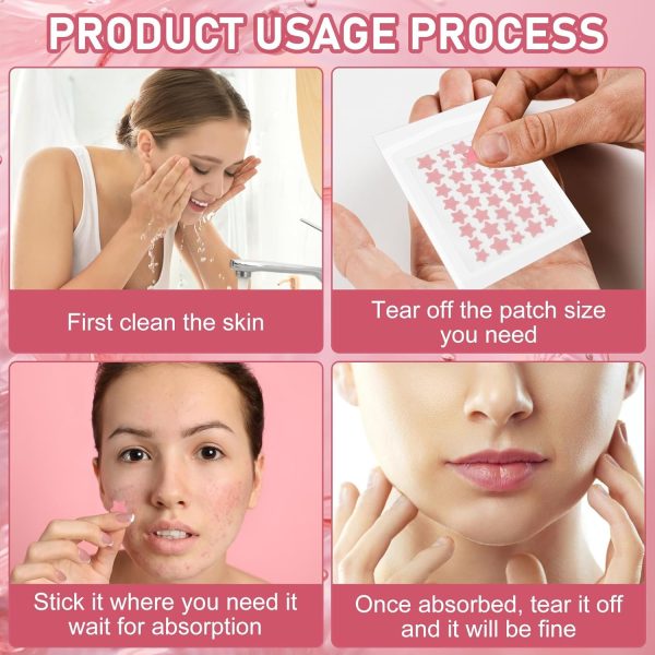 ⁦Paporich 200Pcs Acne Pimple Plasters Stars Pimple Patches, Pimple Patch, Colourful Pimple Patch, Face Care Salicylic Acid Pimple Patches Suitable for Day and Night⁩ - الصورة ⁦4⁩