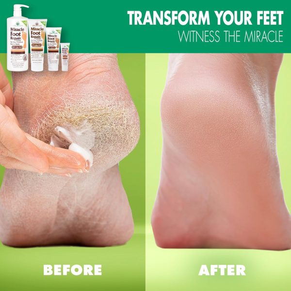 ⁦Miracle of Aloe Foot Repair Cream (8 oz / 2-Pack) Repairs Dry Cracked Heels and Feet, 60% Pure UltraAloe Moisturizes, Softens, and Repairs⁩ - الصورة ⁦5⁩