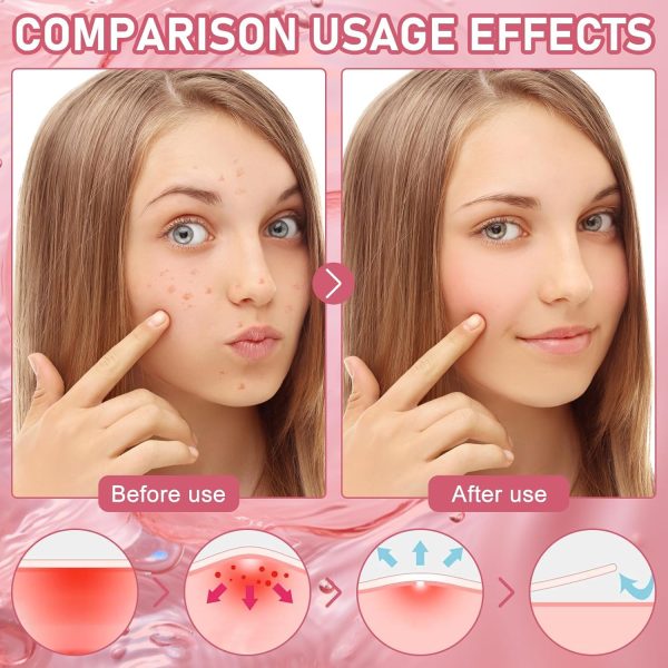 ⁦Paporich 200Pcs Acne Pimple Plasters Stars Pimple Patches, Pimple Patch, Colourful Pimple Patch, Face Care Salicylic Acid Pimple Patches Suitable for Day and Night⁩ - الصورة ⁦6⁩