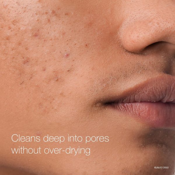 ⁦Neutrogena Rapid Clear Acne Face Pads with Salicylic Acid Acne Treatment Medicine to Fight Face Breakouts, Oil Free Pads with Maximum Strength Salicylic Acid Acne Medicine, 60 ct⁩ - الصورة ⁦6⁩