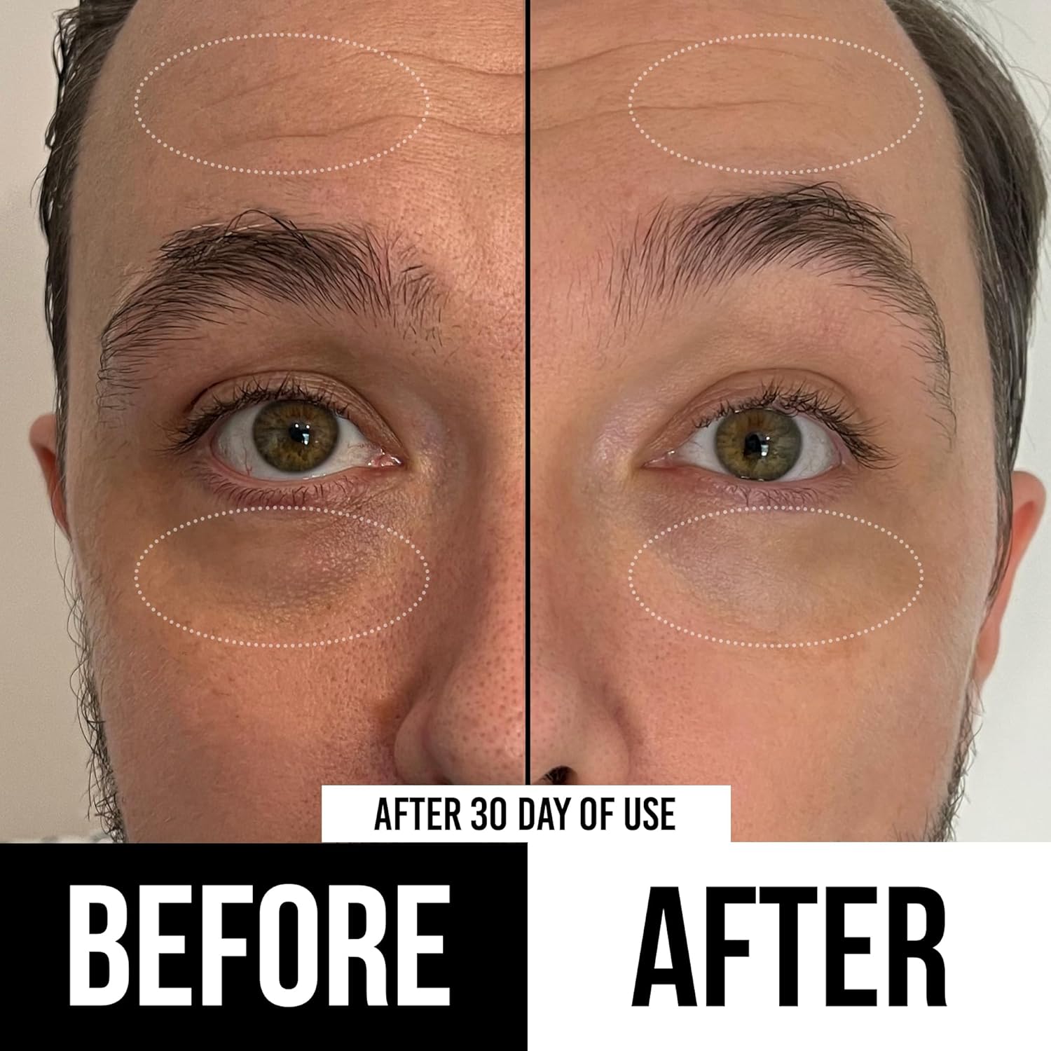 RUGGED & DAPPER- Eye Cream for Men- 1 oz- Powerful Anti Aging Gel Complex- Combats Wrinkles, Dark Circles & Visible Fatigue- Advanced Natural & Organic Ingredients Revives & Defends Entire Face 9 RUGGED & DAPPER- Eye Cream for Men- 1 oz- Powerful Anti Aging Gel Complex- Combats Wrinkles, Dark Circles & Visible Fatigue- Advanced Natural & Organic Ingredients Revives & Defends Entire Face - الصورة 9