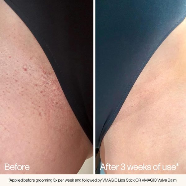 ⁦VMAGIC by Medicine Mama Grooming Polish – All-Natural Exfoliating Sugar Scrub – Preps Skin & Body for Grooming, Helps Prevent Ingrown Hairs – Brazilian Wax & Bikini Shave Aftercare – 4.5 oz⁩ - الصورة ⁦7⁩