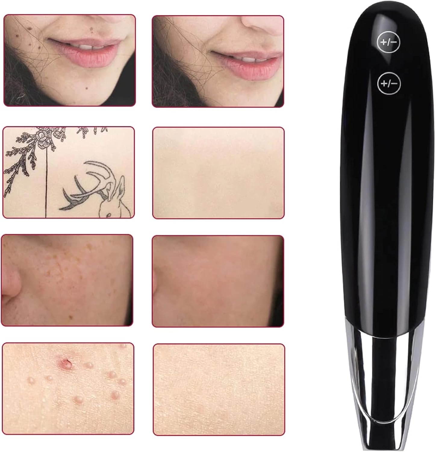 YUEGOO Laser Picosecond Pen Skin Mole Removal Freckle Removal Machine for Home Beauty Salon 9 levels of intensity and 4 speeds 3 YUEGOO Laser Picosecond Pen Skin Mole Removal Freckle Removal Machine for Home Beauty Salon 9 levels of intensity and 4 speeds - الصورة 3