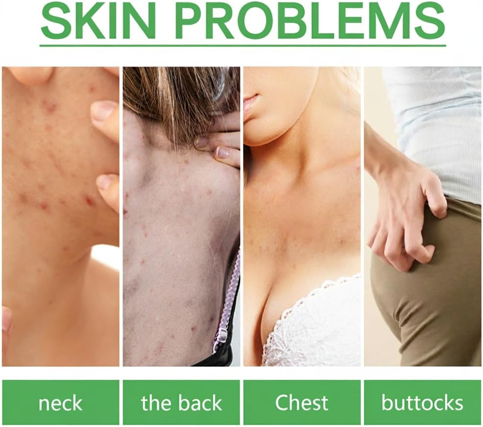 خلاصة الوجه لاصلاح البقع الداكنة من ازوني، مزيل بقع الشيخوخة في الوجه، منتجات ايسنس للعناية بالبشرة، يحتوي على زيت شجرة الشاي وفيتامين E ويضيء لون البشرة ويوحد لون البشرة ويصلح البقع الداكنة المضادة 2 خلاصة الوجه لاصلاح البقع الداكنة من ازوني، مزيل بقع الشيخوخة في الوجه، منتجات ايسنس للعناية بالبشرة، يحتوي على زيت شجرة الشاي وفيتامين E ويضيء لون البشرة ويوحد لون البشرة ويصلح البقع الداكنة المضادة - الصورة 2