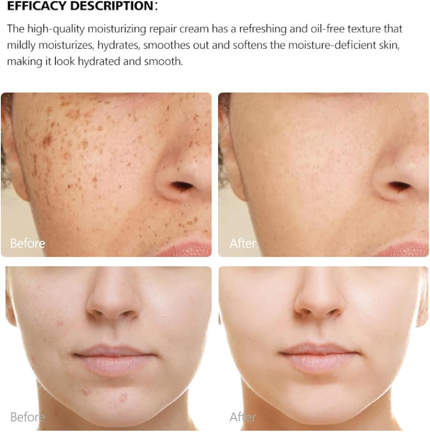 Azonee Hyaluronic Acid Cream for Women, Korean Skincare, Nourishing Moisturizer, Non-Greasy and Fast-Absorbing Ceramide Cream, Hydrates and Smoothes Very Dry Skin 6 Azonee Hyaluronic Acid Cream for Women, Korean Skincare, Nourishing Moisturizer, Non-Greasy and Fast-Absorbing Ceramide Cream, Hydrates and Smoothes Very Dry Skin - الصورة 6