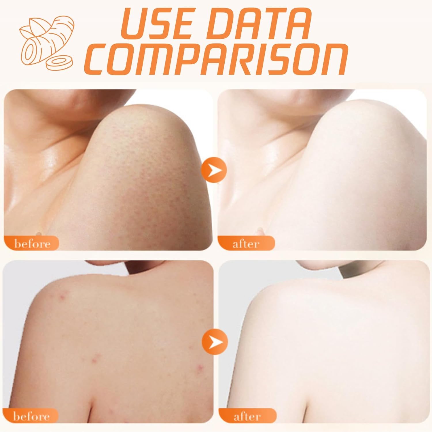 NALACAL Turmeric Exfoliating Body Scrub – Vitamin C Infused Scrub for Deep Cleansing, Removing Dead Skin, and Fading Dark Spots – Face and Body Exfoliator for Women and Men, 250g 3 NALACAL Turmeric Exfoliating Body Scrub – Vitamin C Infused Scrub for Deep Cleansing, Removing Dead Skin, and Fading Dark Spots – Face and Body Exfoliator for Women and Men, 250g - الصورة 3