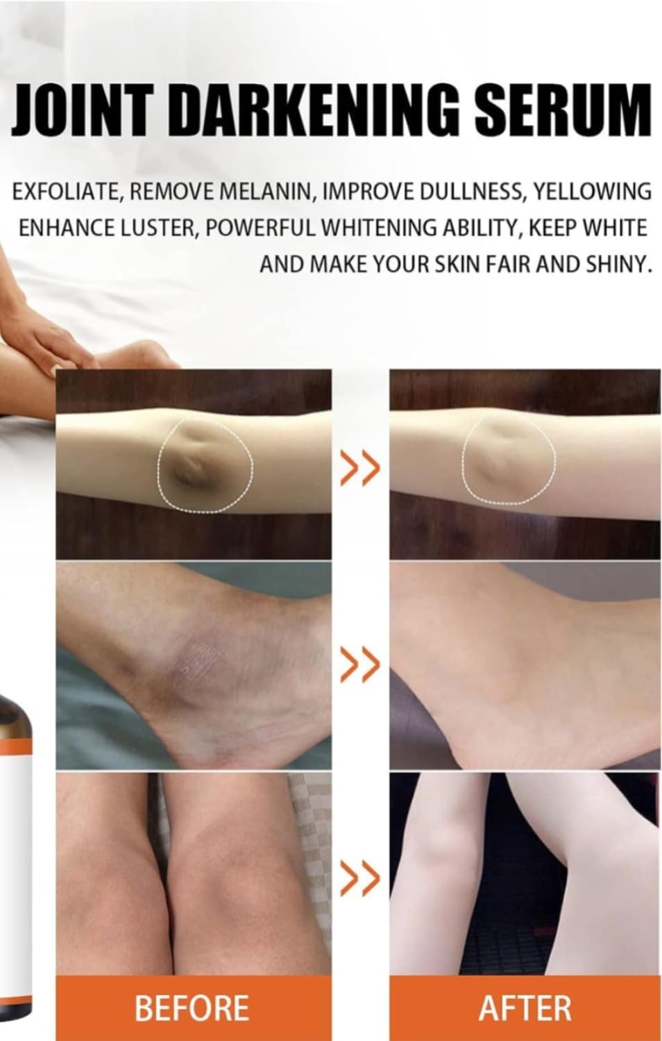 SADOER Niacinamide Vitamin C Serum for Whitening Feet, Joints, Dark Places 50ml 4 SADOER Niacinamide Vitamin C Serum for Whitening Feet, Joints, Dark Places 50ml - الصورة 4