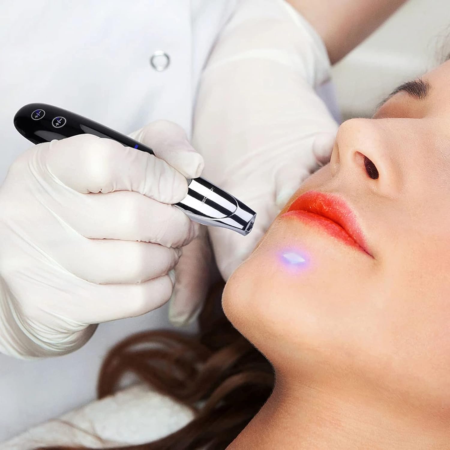 YUEGOO Laser Picosecond Pen Skin Mole Removal Freckle Removal Machine for Home Beauty Salon 9 levels of intensity and 4 speeds 4 YUEGOO Laser Picosecond Pen Skin Mole Removal Freckle Removal Machine for Home Beauty Salon 9 levels of intensity and 4 speeds - الصورة 4