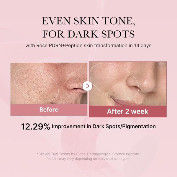⁦Medicube PDRN Pink Deer Soothing Toner, Lotion, PDRN, Salmon Injection, Hypoallergenic, Beam, Wiping Lotion, Moisture Moisturizing, Moist Lotion, Oily Skin, Skin Care, Korean Cosmetics⁩ - الصورة ⁦2⁩
