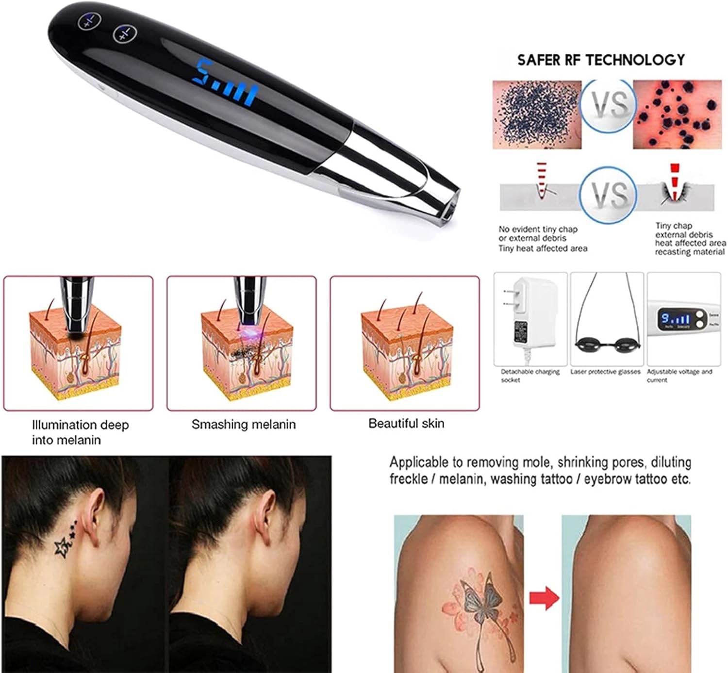 YUEGOO Laser Picosecond Pen Skin Mole Removal Freckle Removal Machine for Home Beauty Salon 9 levels of intensity and 4 speeds 2 YUEGOO Laser Picosecond Pen Skin Mole Removal Freckle Removal Machine for Home Beauty Salon 9 levels of intensity and 4 speeds - الصورة 2
