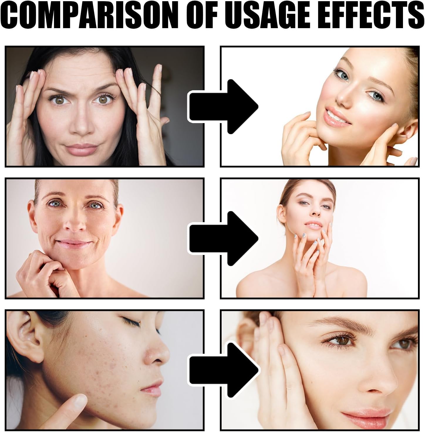 مصل وجه دراجون بلود من ماكبيتي، مرطب لشد الوجه ورفعه، مصل وجه مضاد للتجاعيد للنساء، مزيل البقع الداكنة للوجه، اصلاح وتهدئة وتجديد وحماية بشرتك 6 مصل وجه دراجون بلود من ماكبيتي، مرطب لشد الوجه ورفعه، مصل وجه مضاد للتجاعيد للنساء، مزيل البقع الداكنة للوجه، اصلاح وتهدئة وتجديد وحماية بشرتك - الصورة 6