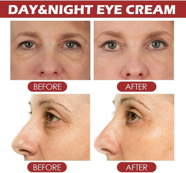 ⁦NOVOLAN Retinol Day & Night Eye Cream Stick 4g Dual-Action Eye Care, Diminishes Fine Lines and Wrinkles, Reduces Under-Eye Bags and Puffiness, Fades Dark Circles, Deep Hydration and Moisture⁩ - الصورة ⁦6⁩
