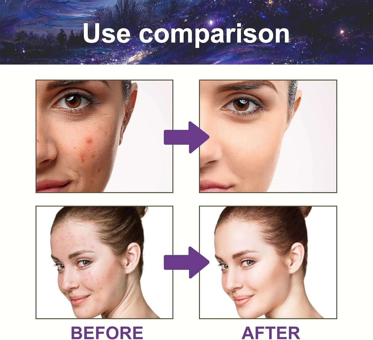 رقع بثور على شكل نجوم، 180 رقعة بثرة للوجه، رقع حب الشباب الغروانية المائية، رقع البثور والنجوم، رقع زيت لزيتس والعيوب والكسر، مقاومة للماء وجيدة التهوية للبشرة المعرضة لحب الشباب 9 رقع بثور على شكل نجوم، 180 رقعة بثرة للوجه، رقع حب الشباب الغروانية المائية، رقع البثور والنجوم، رقع زيت لزيتس والعيوب والكسر، مقاومة للماء وجيدة التهوية للبشرة المعرضة لحب الشباب - الصورة 9