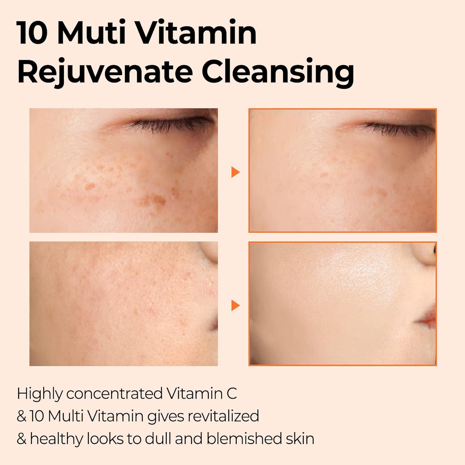 SOME BY MI Pure Vitamin C V10 Cleansing Bar 106g 3 SOME BY MI Pure Vitamin C V10 Cleansing Bar 106g - الصورة 3