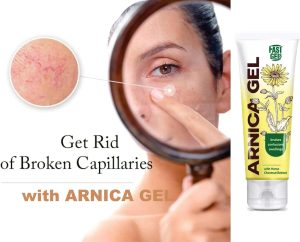 جل سريع للعناية بالبشرة لتخفيف الكدمات والانتفاخات من ارنيكا، 50 جرام، من نوفاكلير