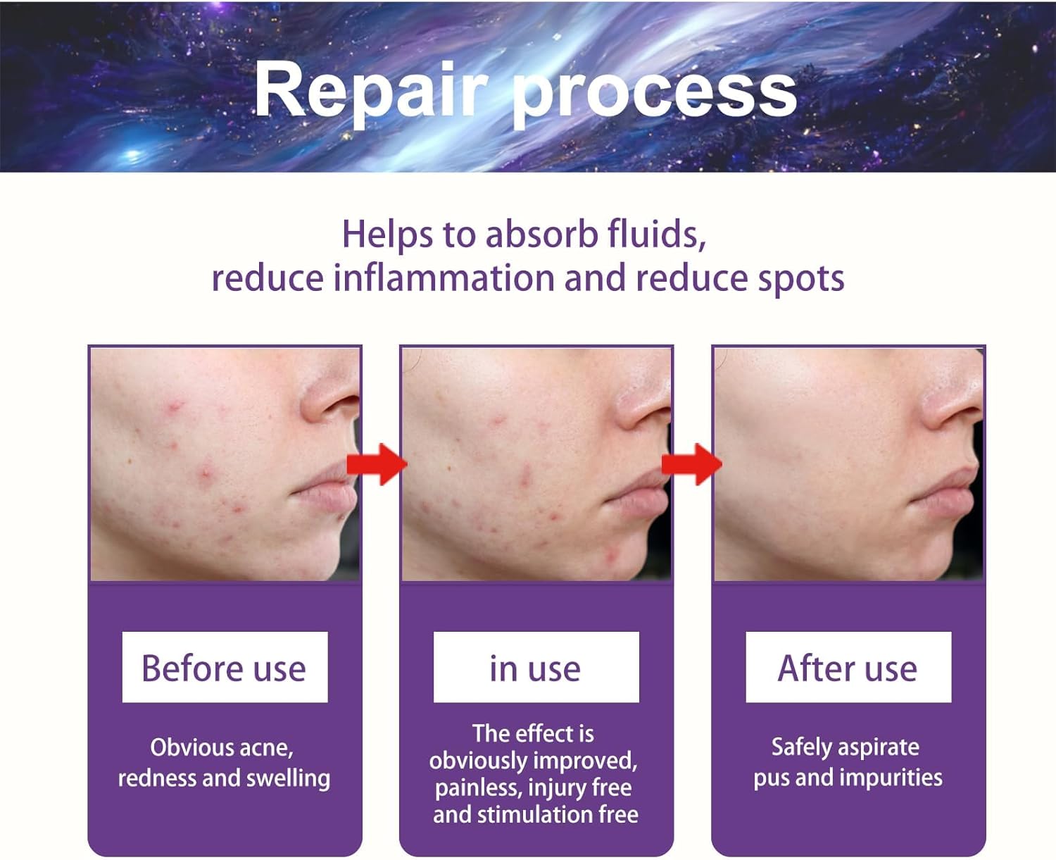 رقع بثور على شكل نجوم، 180 رقعة بثرة للوجه، رقع حب الشباب الغروانية المائية، رقع البثور والنجوم، رقع زيت لزيتس والعيوب والكسر، مقاومة للماء وجيدة التهوية للبشرة المعرضة لحب الشباب 7 رقع بثور على شكل نجوم، 180 رقعة بثرة للوجه، رقع حب الشباب الغروانية المائية، رقع البثور والنجوم، رقع زيت لزيتس والعيوب والكسر، مقاومة للماء وجيدة التهوية للبشرة المعرضة لحب الشباب - الصورة 7