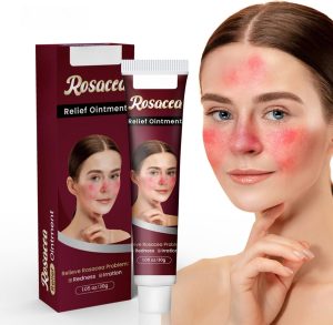 NOVOLAN Rosacea Relief Ointment 30g, Soothing Cream for Redness & Irritation, Effective Treatment for Rosacea, Helps Restore Skin Balance, Antibacterial Properties to Reduce Breakouts, Sensitive Skin