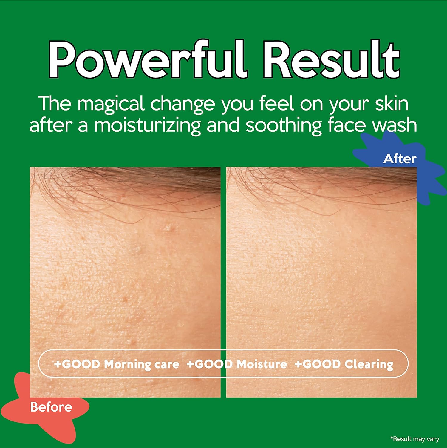 منظف جل لطيف تروبليس غسول وجه مرطب مع خلاصة شجرة الشاي للبشرة الحساسة تنظيف لمشاكل البشرة منخفض الحموضة صباحي 405 اونصة سائلة 5 منظف جل لطيف تروبليس غسول وجه مرطب مع خلاصة شجرة الشاي للبشرة الحساسة تنظيف لمشاكل البشرة منخفض الحموضة صباحي 405 اونصة سائلة - الصورة 5