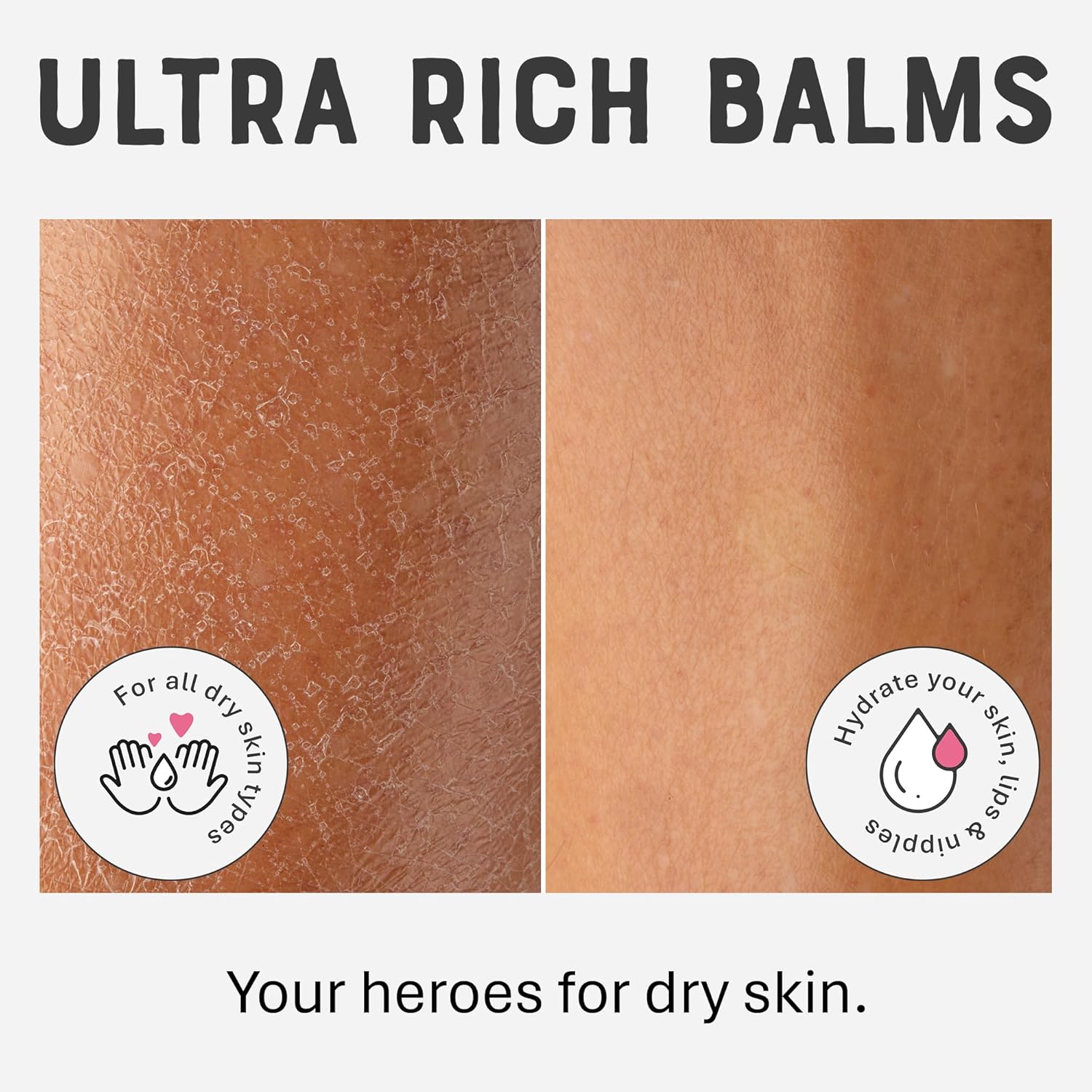 بلسم بي اف وبلسم اصلي هيرو للبشرة الجافة من دكتور ليب. 14 في اثنين. مرطب للوجه لليدين الشفاه وكريم الزوائد اللحمية وما الى ذلك. مصدر طبيعي 100% كريم 30 مل اوريجينال 15 4 بلسم بي اف وبلسم اصلي هيرو للبشرة الجافة من دكتور ليب. 14 في اثنين. مرطب للوجه لليدين الشفاه وكريم الزوائد اللحمية وما الى ذلك. مصدر طبيعي 100% كريم 30 مل اوريجينال 15 - الصورة 4