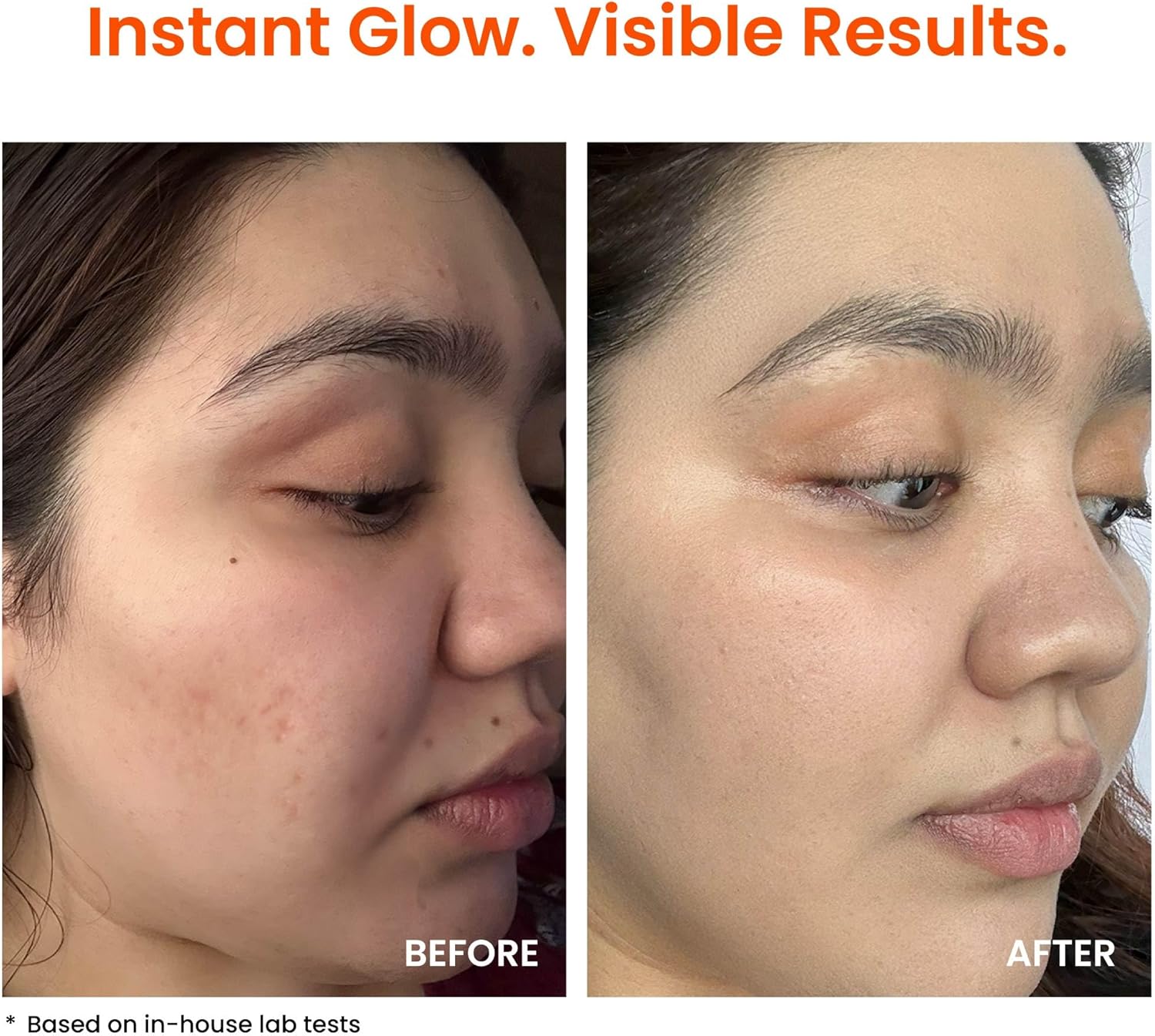 FoxTale Super Glow Moisturizer Cream With Nano Vitamin C | Niacinamide | Encapsulated Peptides Bright Skin From 1St Use | Goes 2X Deeper | For All Skin Types | Men & Women - 50Ml (Pack Of 2) 6 FoxTale Super Glow Moisturizer Cream With Nano Vitamin C | Niacinamide | Encapsulated Peptides Bright Skin From 1St Use | Goes 2X Deeper | For All Skin Types | Men & Women - 50Ml (Pack Of 2) - الصورة 6