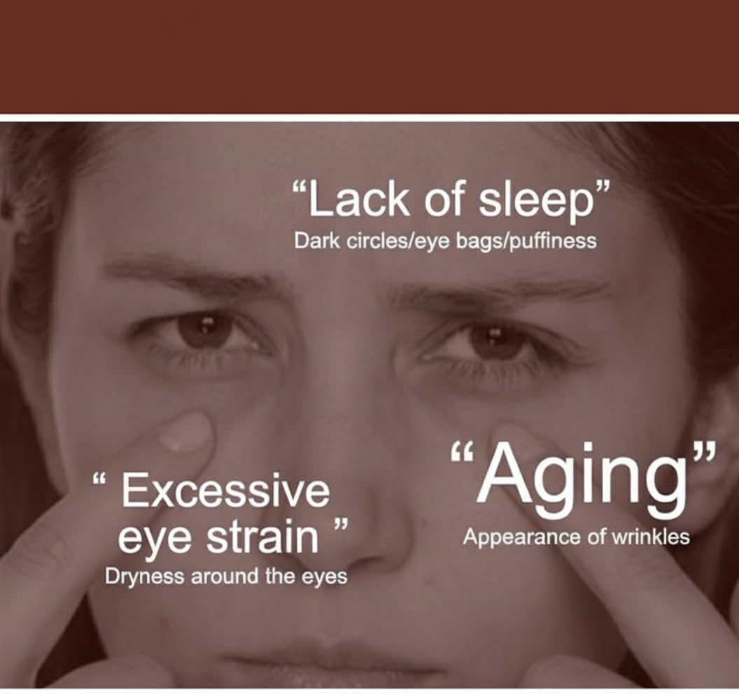 كريم للعيون من نالاكال لتقليل الهالات السوداء والانتفاخ والتجاعيد وترطيب عميق، مناسب لجميع أنواع البشرة، 20 جرام 2 كريم للعيون من نالاكال لتقليل الهالات السوداء والانتفاخ والتجاعيد وترطيب عميق، مناسب لجميع أنواع البشرة، 20 جرام - الصورة 2