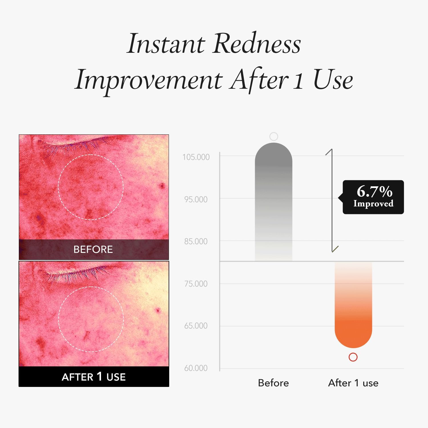 ضمادة للوجه من ابريل سكن مُغذية للبشرة الحسّاسة، 80 وسادة (7 سم) و 220 مل 4 ضمادة للوجه من ابريل سكن مُغذية للبشرة الحسّاسة، 80 وسادة (7 سم) و 220 مل - الصورة 4