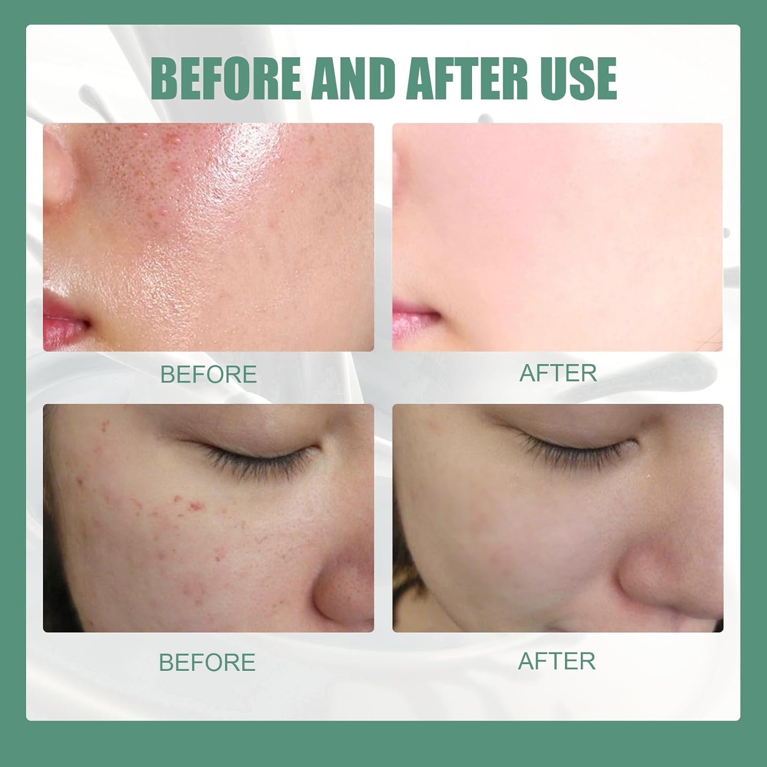 منظف الوجه المرطب من ماتشا، منظف للوجه اليومي غير قابل للتجريد، جل مرطب كلي/ انسر، للوجه لجميع انواع البشرة، منظف للوجه لجميع انواع البشرة 2 منظف الوجه المرطب من ماتشا، منظف للوجه اليومي غير قابل للتجريد، جل مرطب كلي/ انسر، للوجه لجميع انواع البشرة، منظف للوجه لجميع انواع البشرة - الصورة 2