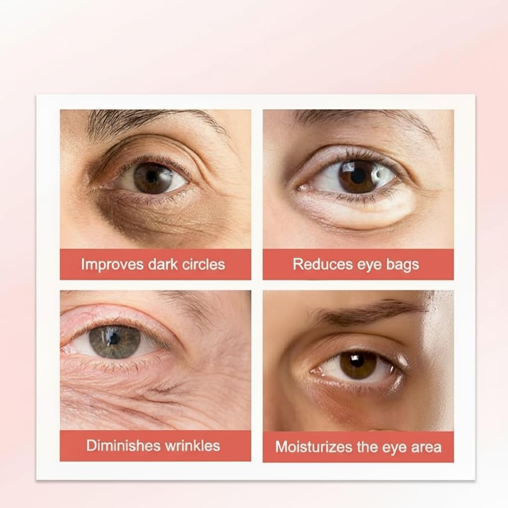 كريم للعيون من نالاكال لتقليل الهالات السوداء والانتفاخ والتجاعيد وترطيب عميق، مناسب لجميع أنواع البشرة، 20 جرام 3 كريم للعيون من نالاكال لتقليل الهالات السوداء والانتفاخ والتجاعيد وترطيب عميق، مناسب لجميع أنواع البشرة، 20 جرام - الصورة 3