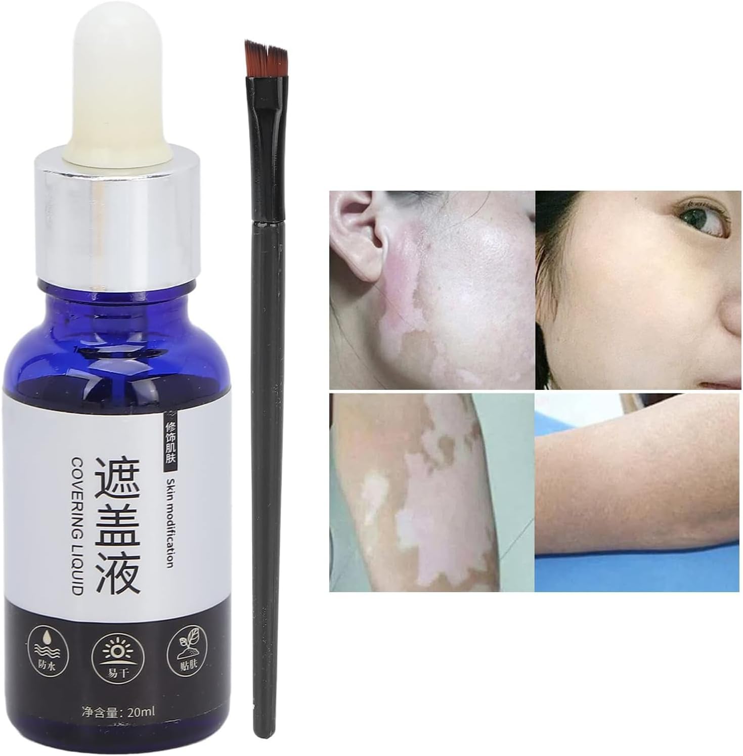 سائل لتغطية البهاق 20 مل، غطاء سائل مقاوم للماء للبهاق، كونسيلر بلون البشرة 4 سائل لتغطية البهاق 20 مل، غطاء سائل مقاوم للماء للبهاق، كونسيلر بلون البشرة - الصورة 4