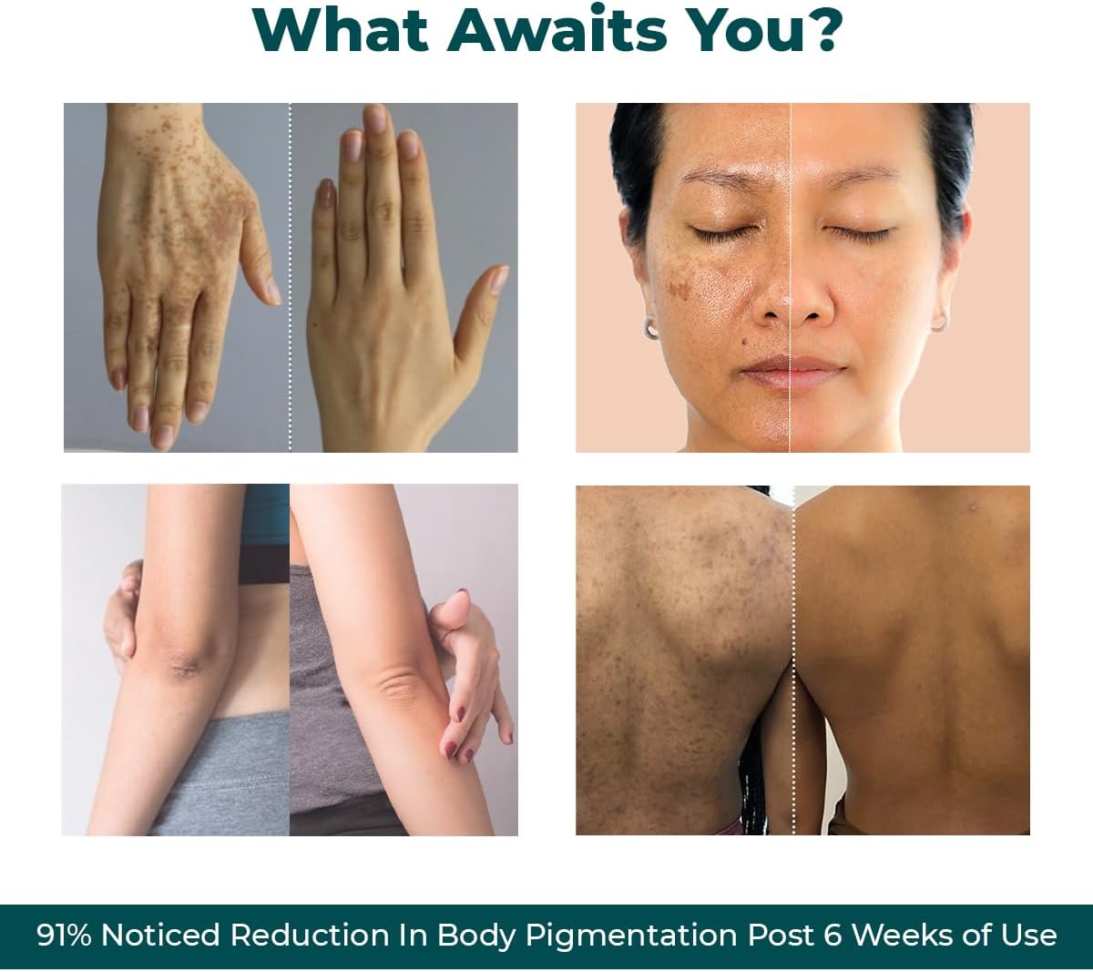 كريم للوجه من كونشس كيمست لإزالة التصبغات والبقع الداكنة، مناسب لجميع أنواع البشرة، 50 جرام 6 كريم للوجه من كونشس كيمست لإزالة التصبغات والبقع الداكنة، مناسب لجميع أنواع البشرة، 50 جرام - الصورة 6