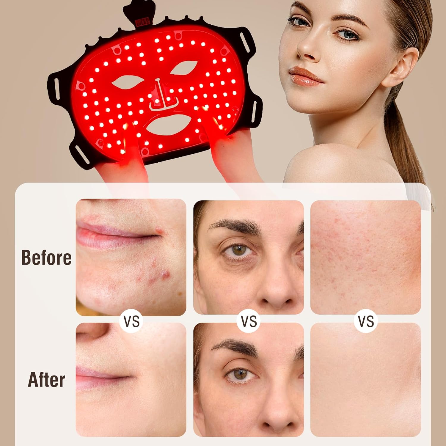 قناع علاج بالضوء الاحمر من انجوس 7 الوان وجه لاسلكي باضاءة LED مع وسادة حماية للعين خفيف الوزن السيليكون الناعم للعلاج للوجه لتقليل التجاعيد ومكافحة الشيخوخة كل الأنواع 3 قناع علاج بالضوء الاحمر من انجوس 7 الوان وجه لاسلكي باضاءة LED مع وسادة حماية للعين خفيف الوزن السيليكون الناعم للعلاج للوجه لتقليل التجاعيد ومكافحة الشيخوخة كل الأنواع - الصورة 3