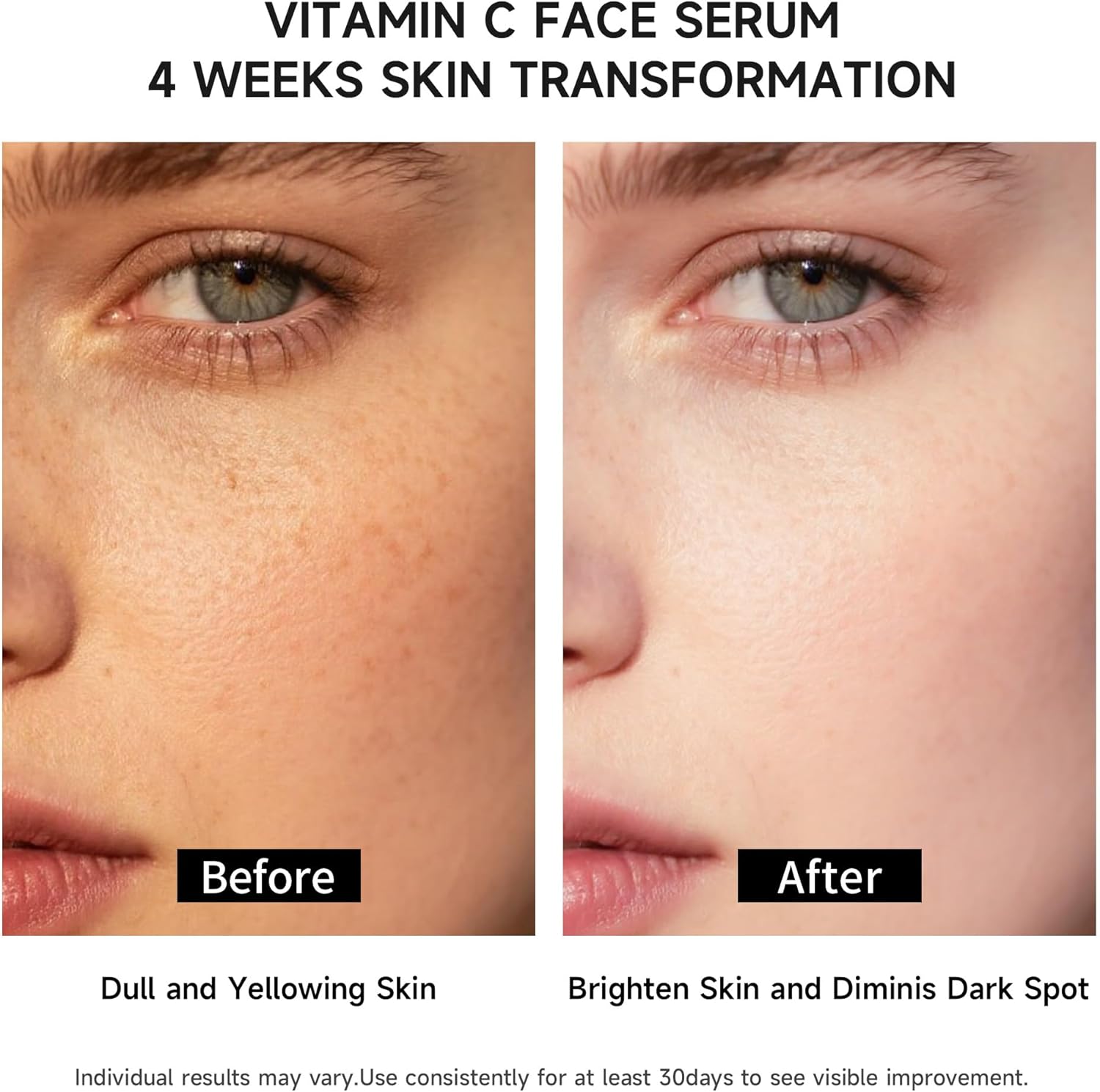 سيروم فيتامين سي للوجه بحمض الهيالورونيك والجلوتاثيون وخلاصة الصبار العضوي ومصل مرطب وتفتيح ومزيل البقع الداكنة ومكافحة علامات التقدم في السن من باتشيري، 30 امبولة، لكل انواع البشرة، للجنسين 3 سيروم فيتامين سي للوجه بحمض الهيالورونيك والجلوتاثيون وخلاصة الصبار العضوي ومصل مرطب وتفتيح ومزيل البقع الداكنة ومكافحة علامات التقدم في السن من باتشيري، 30 امبولة، لكل انواع البشرة، للجنسين - الصورة 3