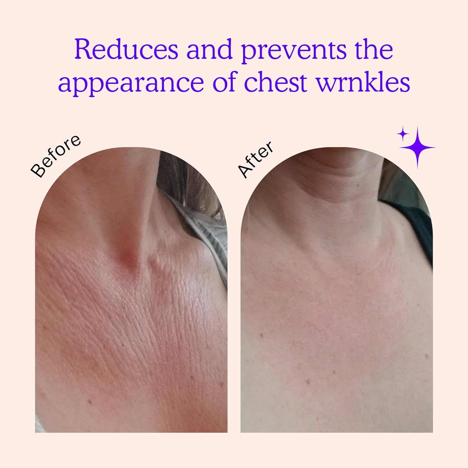 وسائد تجاعيد الصدر - مضادة للشيخوخة لشد البشرة وترطيبها ومنع الخطوط الدقيقة - رقع سيليكون آمنة للعناية بالبشرة - قابلة لإعادة الاستخدام طوال الليل من أجل الشقوق والديكولتيه (كمية من شهرين) 2 وسائد تجاعيد الصدر - مضادة للشيخوخة لشد البشرة وترطيبها ومنع الخطوط الدقيقة - رقع سيليكون آمنة للعناية بالبشرة - قابلة لإعادة الاستخدام طوال الليل من أجل الشقوق والديكولتيه (كمية من شهرين) - الصورة 2