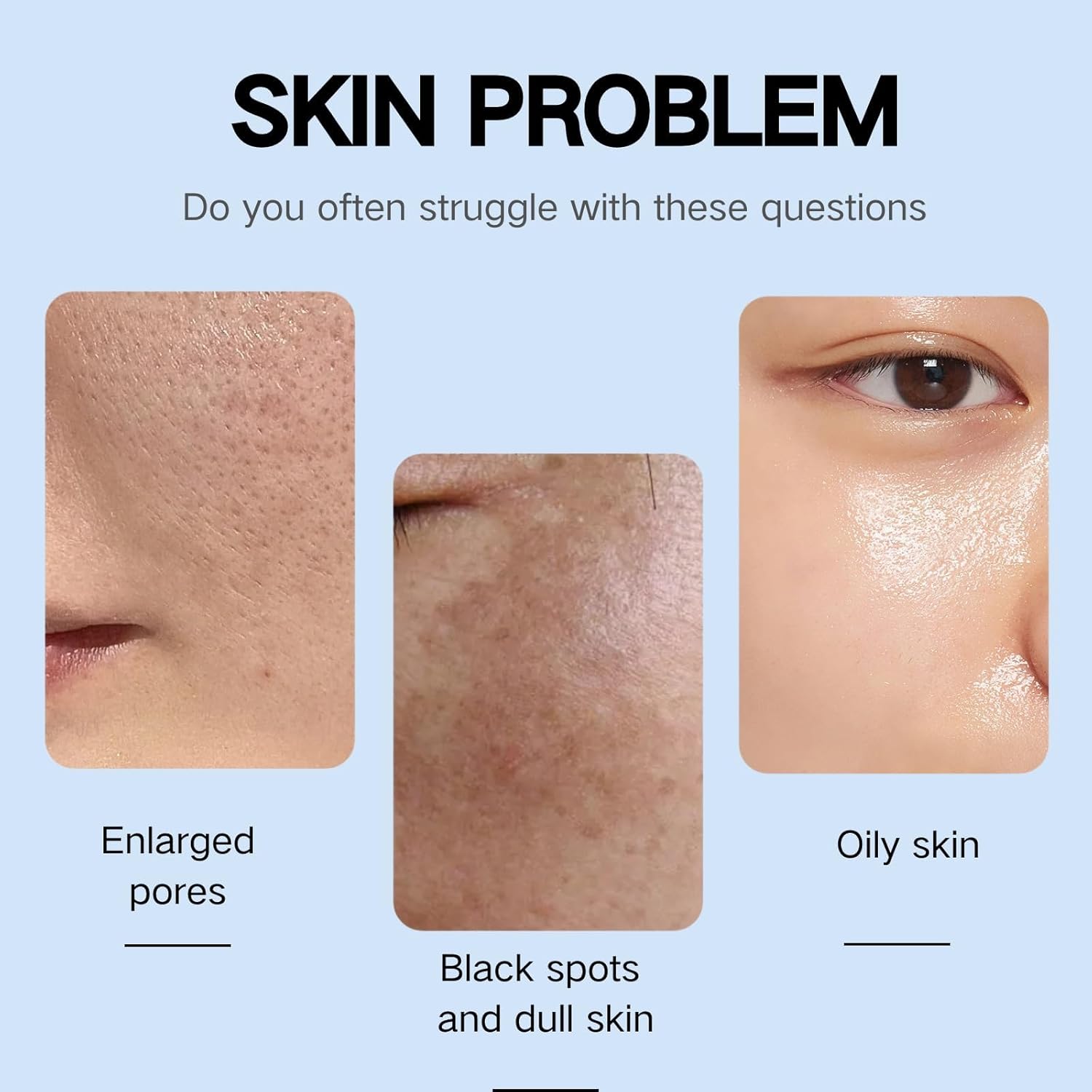 تونر بحمض الجليكوليك من ازوني، تونر مرطب للوجه، حمض الجليكوليك 7%، تونر تجميل، للعناية بالبشرة وتكرير المسام، تونر مرطب، مقشر الوجه، تونر للوجه للتحكم في الزيوت واصلاح حب الشباب ومكافحة الشيخوخة 4 تونر بحمض الجليكوليك من ازوني، تونر مرطب للوجه، حمض الجليكوليك 7%، تونر تجميل، للعناية بالبشرة وتكرير المسام، تونر مرطب، مقشر الوجه، تونر للوجه للتحكم في الزيوت واصلاح حب الشباب ومكافحة الشيخوخة - الصورة 4