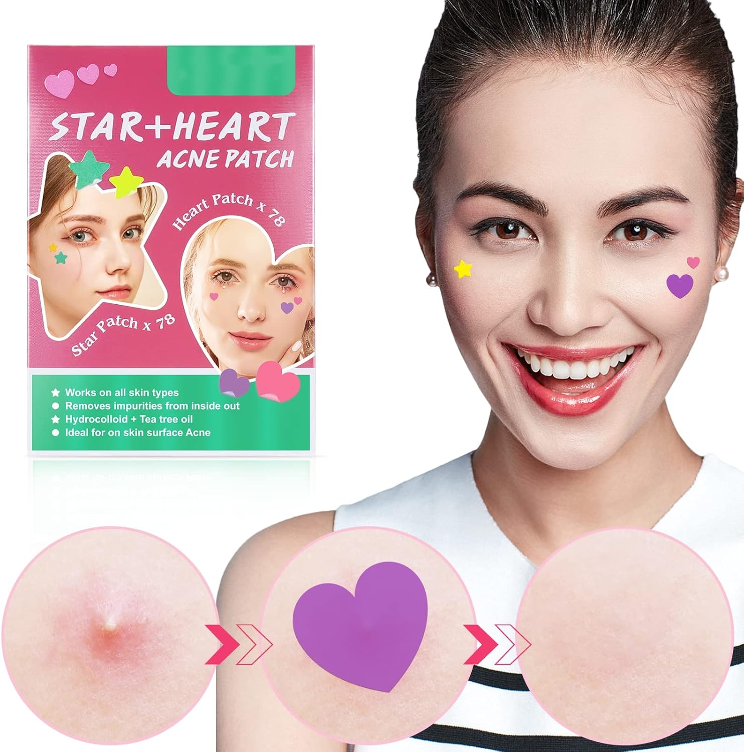 126 قطعة من الرقع الملونة لازالة حب الشباب من هونبولو، مكياج لطيف يغطي حب الشباب على شكل قلب ونجوم، رقع دائرية لازالة حب الشباب، 3 انماط (احمر) 2 126 قطعة من الرقع الملونة لازالة حب الشباب من هونبولو، مكياج لطيف يغطي حب الشباب على شكل قلب ونجوم، رقع دائرية لازالة حب الشباب، 3 انماط (احمر) - الصورة 2