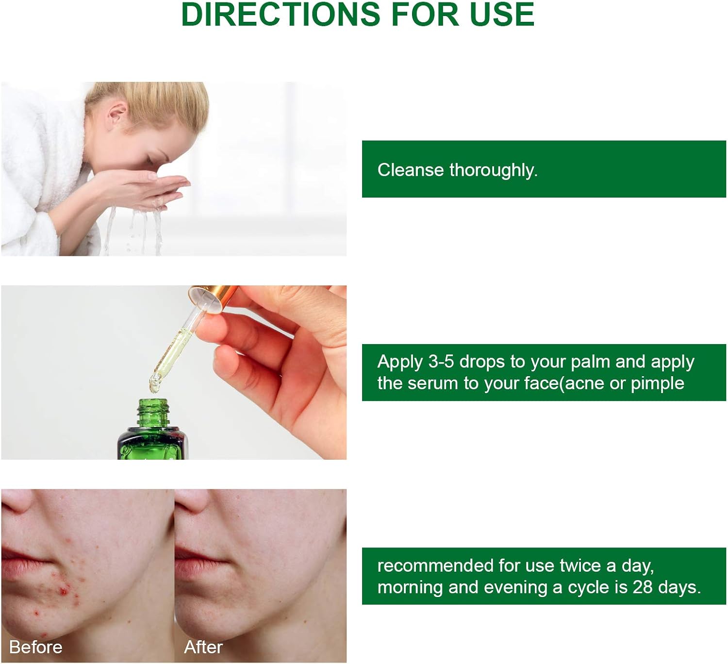 ال بوب مصل علاجات حب الشباب لعلاج بقع حب الشباب، مصل البشرة الشفافة لشجرة الشاي لإزالة حب الشباب الشديد والكسر والبثور وإصلاح البشرة 5 ال بوب مصل علاجات حب الشباب لعلاج بقع حب الشباب، مصل البشرة الشفافة لشجرة الشاي لإزالة حب الشباب الشديد والكسر والبثور وإصلاح البشرة - الصورة 5