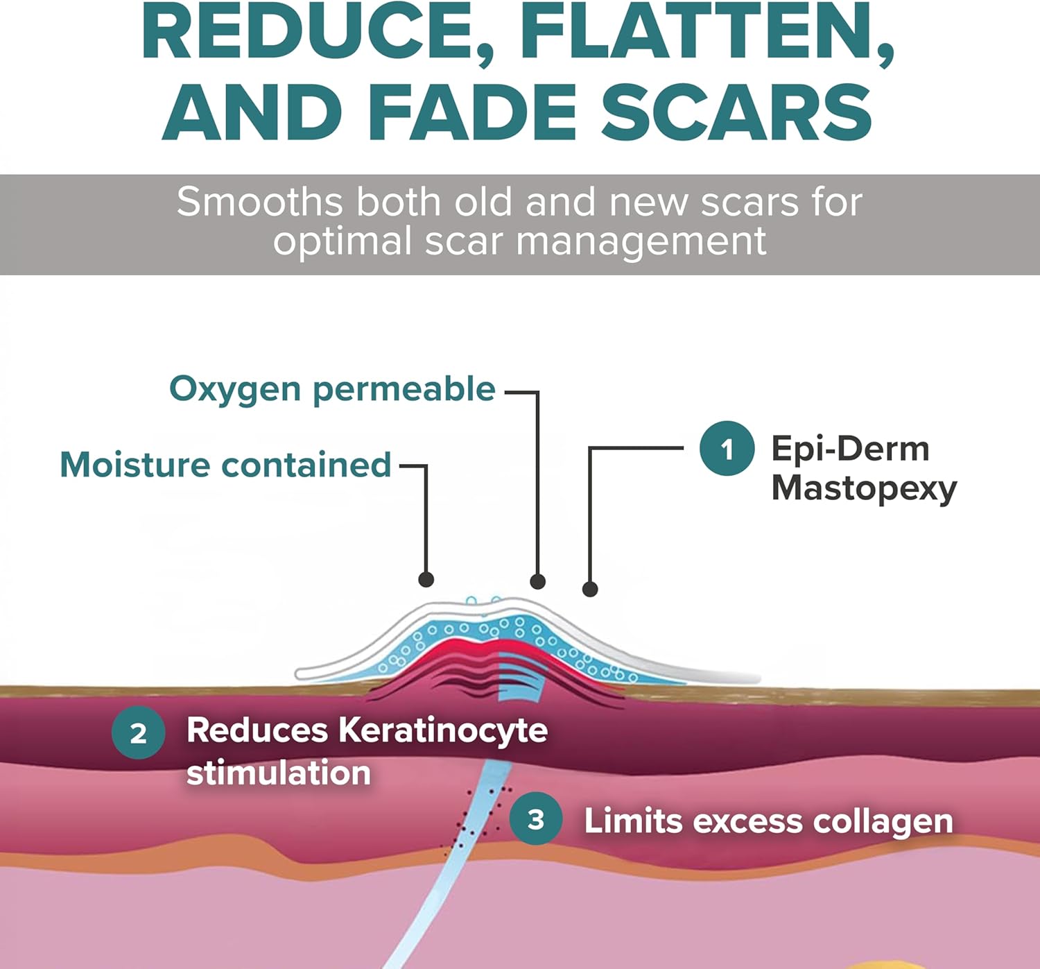 بيوديرميس ايبي ديرم Mastopexy (زوج واحد) 12.6 × 3.8 انش (32.0 × 9.6 سم) طبيعي 4 بيوديرميس ايبي ديرم Mastopexy (زوج واحد) 12.6 × 3.8 انش (32.0 × 9.6 سم) طبيعي - الصورة 4
