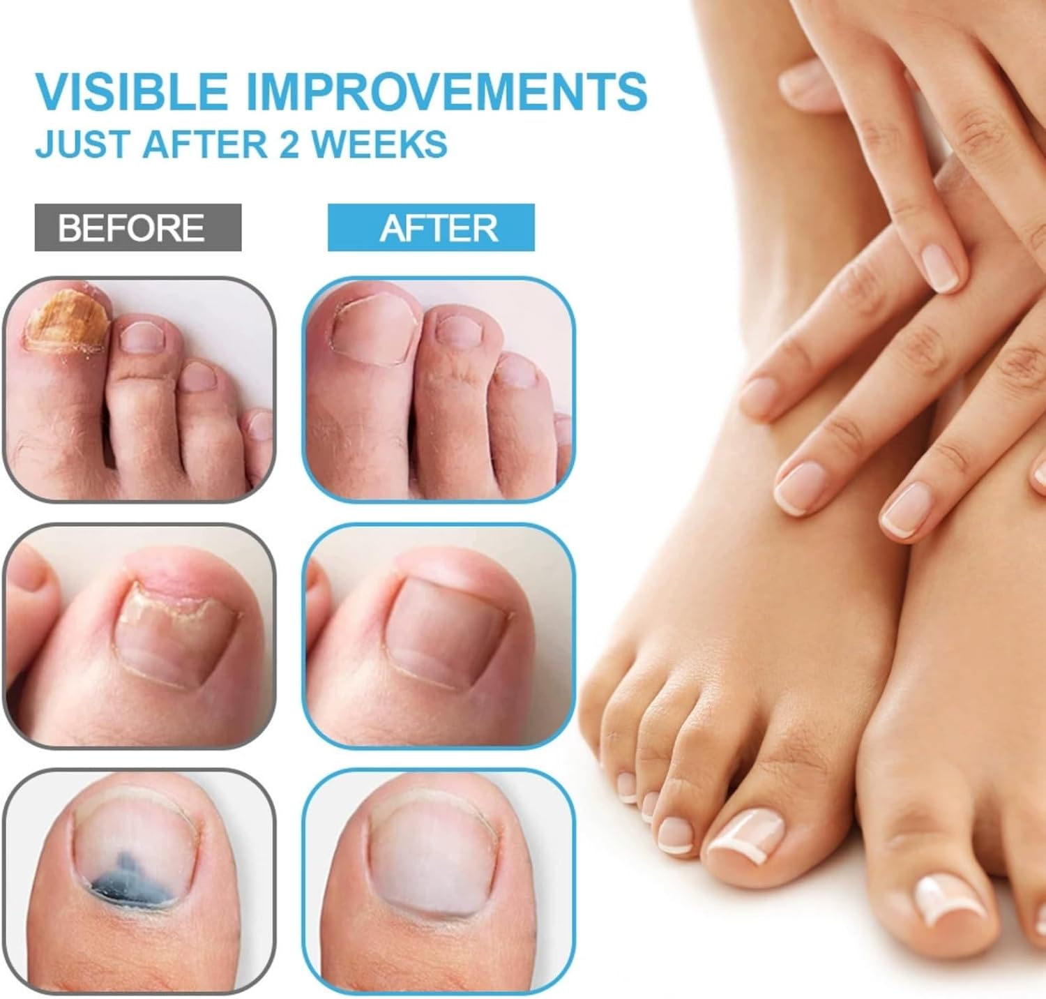 قلم العناية بالاظافر حل لطيف لاظافر القدم والاظافر، تركيبة مغذية 4 مل لتنعيم وترطيب وازالة الروائح الكريهة للاظافر النامية والاظافر السميكة، يحافظ على صحة الاظافر 3 قلم العناية بالاظافر حل لطيف لاظافر القدم والاظافر، تركيبة مغذية 4 مل لتنعيم وترطيب وازالة الروائح الكريهة للاظافر النامية والاظافر السميكة، يحافظ على صحة الاظافر - الصورة 3