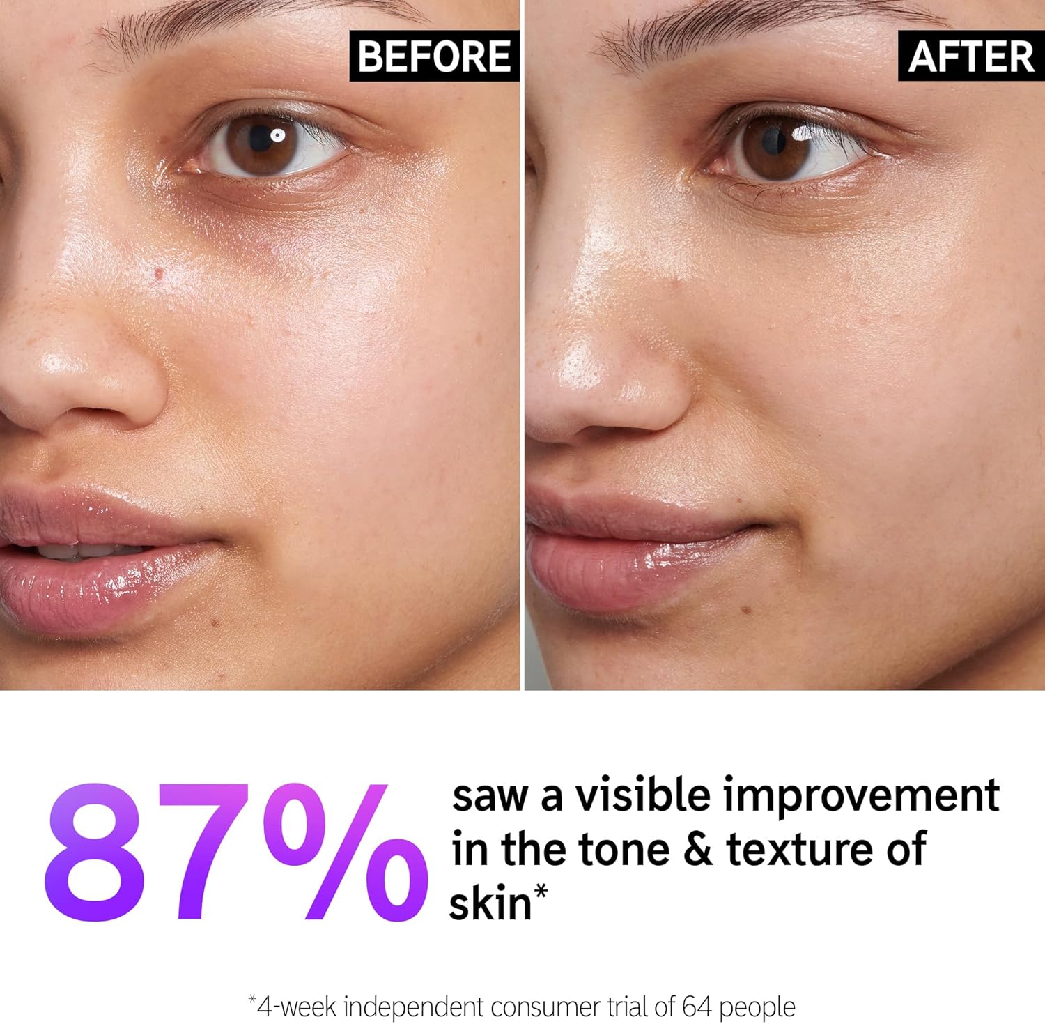 سيروم فيتامين سي وEGF بنسبة 15% من ذا انكي ليست يساعد على تفتيح جميع انواع البشرة بشكل مكثف، 30 مل، للجنسين، 30.0 ملليلتر 2 سيروم فيتامين سي وEGF بنسبة 15% من ذا انكي ليست يساعد على تفتيح جميع انواع البشرة بشكل مكثف، 30 مل، للجنسين، 30.0 ملليلتر - الصورة 2