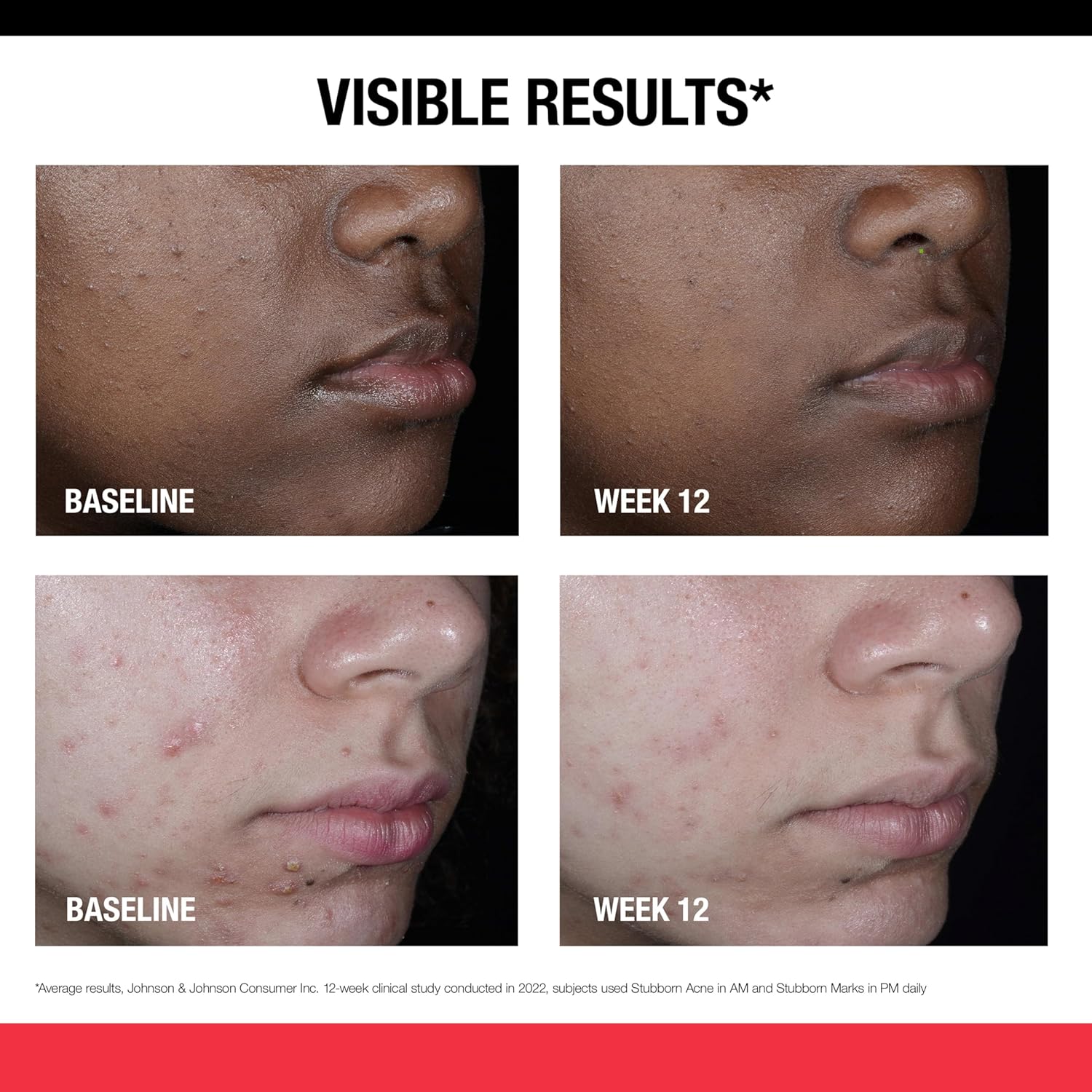 نيوتريجينا مستحضر العناية بالبشرة من ستاببورن ماركس مع ريتينول اس ايه علاج تقشير الوجه للمساعدة في عكس مظهر علامات ما بعد حب الشباب وتفاوت لون البشرة خالٍ الزيوت ولا يسبب انسداد المسام 1 اونصة 4 نيوتريجينا مستحضر العناية بالبشرة من ستاببورن ماركس مع ريتينول اس ايه علاج تقشير الوجه للمساعدة في عكس مظهر علامات ما بعد حب الشباب وتفاوت لون البشرة خالٍ الزيوت ولا يسبب انسداد المسام 1 اونصة - الصورة 4