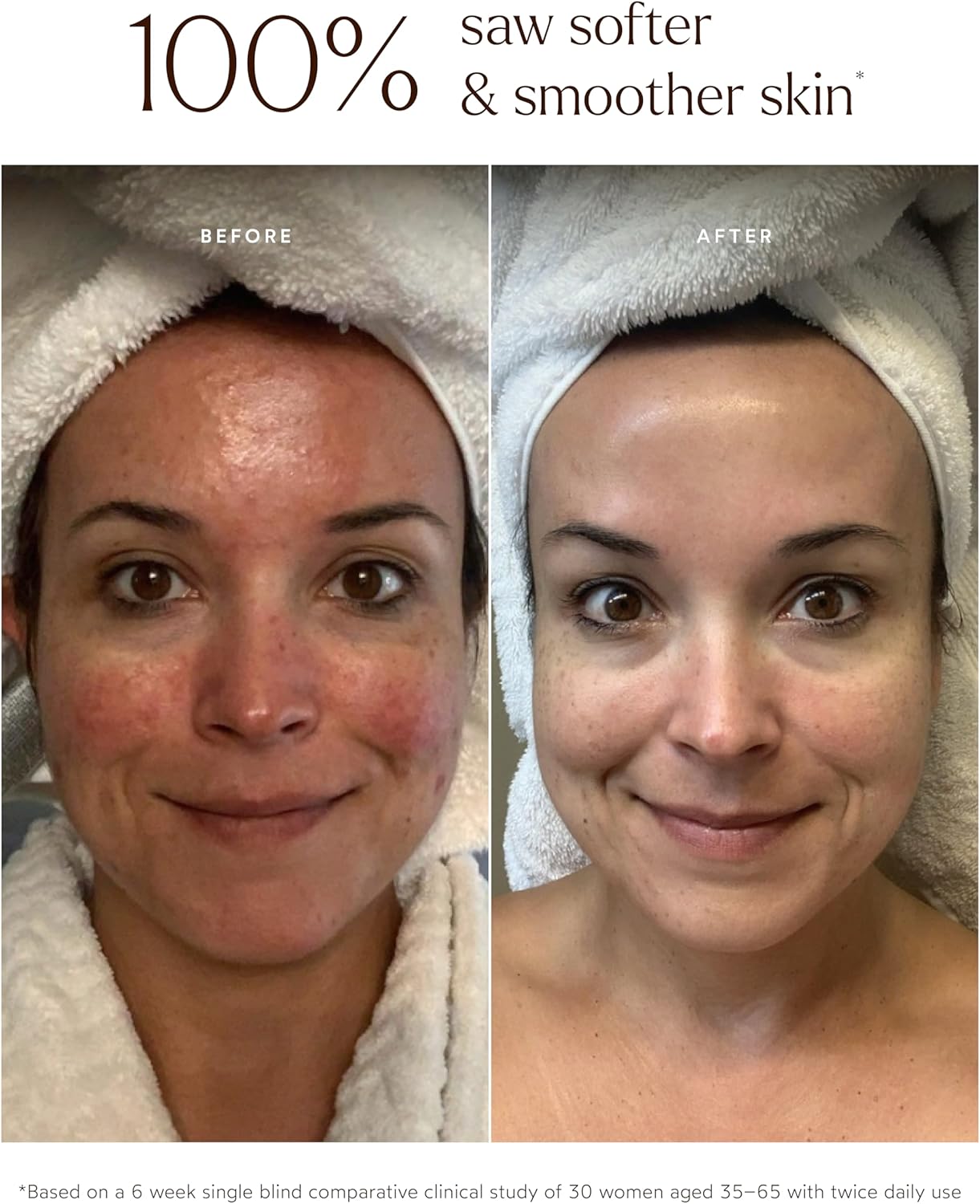 ترو بوتانيكالز - سيروم تشيبولا اكتيف الطبيعي | نظيف وغير سام وطبيعي للعناية بالبشرة (1 اونصة سائلة | 30 مل) 5 ترو بوتانيكالز - سيروم تشيبولا اكتيف الطبيعي | نظيف وغير سام وطبيعي للعناية بالبشرة (1 اونصة سائلة | 30 مل) - الصورة 5