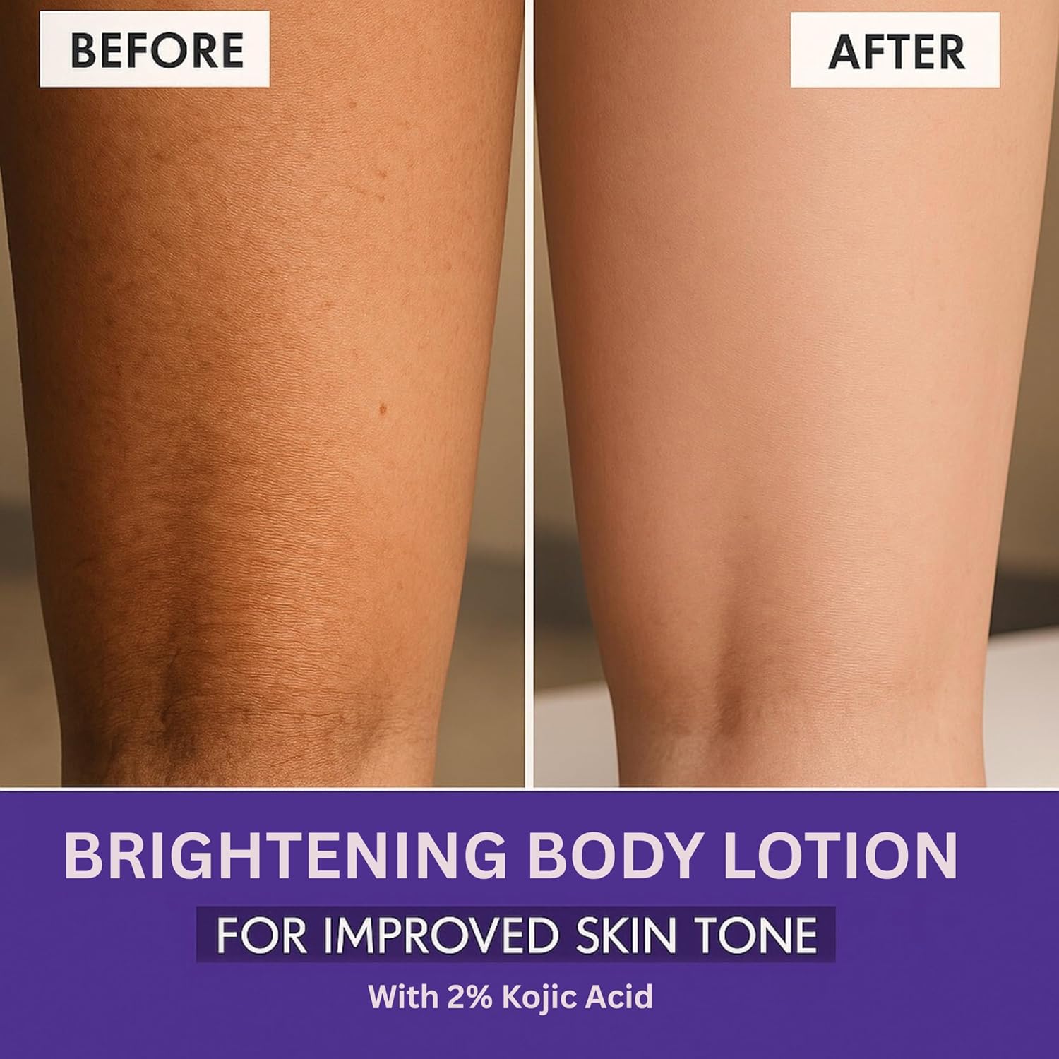 لوشن للجسم بحمض كوجيك بنسبة 2% مع نياسيناميد وعامل حماية من الشمس 30 PA+++ لإزالة التصبغات والاسمرار | إزالة البقع الداكنة والحماية من الشمس | للبشرة السمراء والمتصبغة من بيك | للنساء والرجال | 200 مل 3 لوشن للجسم بحمض كوجيك بنسبة 2% مع نياسيناميد وعامل حماية من الشمس 30 PA+++ لإزالة التصبغات والاسمرار | إزالة البقع الداكنة والحماية من الشمس | للبشرة السمراء والمتصبغة من بيك | للنساء والرجال | 200 مل - الصورة 3