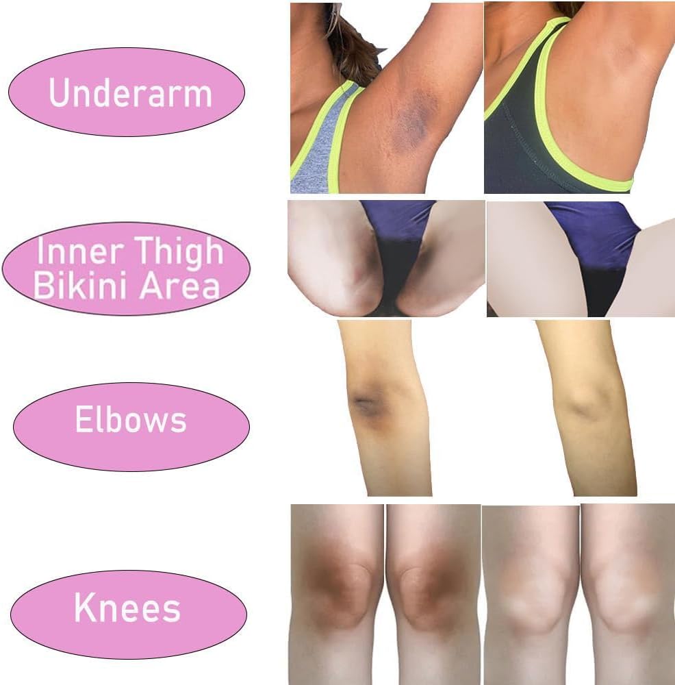 61cWcnjPx L. AC SL1000