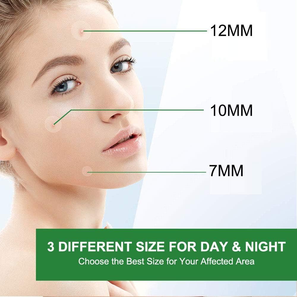 61fYzX8YMBL. AC SL1000