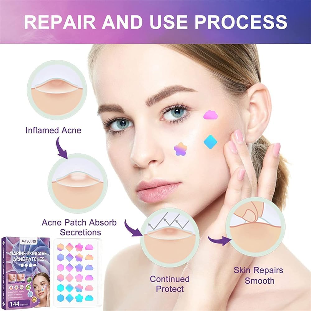 رقع حب الشباب للوجه بخلاصة الطحالب الخضراء الطبيعية وزيت شجرة الشاي الغروانية المائية رقعة تغطية ماصة لحب على شكل نجمة ملونة تغطي وتقلل من النتوءات والبثور 144 نيو تايملي 2 رقع حب الشباب للوجه بخلاصة الطحالب الخضراء الطبيعية وزيت شجرة الشاي الغروانية المائية رقعة تغطية ماصة لحب على شكل نجمة ملونة تغطي وتقلل من النتوءات والبثور 144 نيو تايملي - الصورة 2